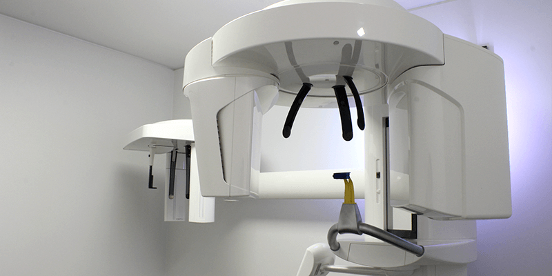 歯科用CT（CBCT）の画像